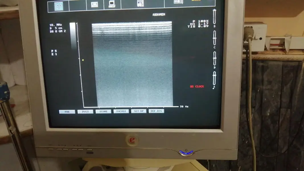 Ultrasound Machine imported

                                                            alt=