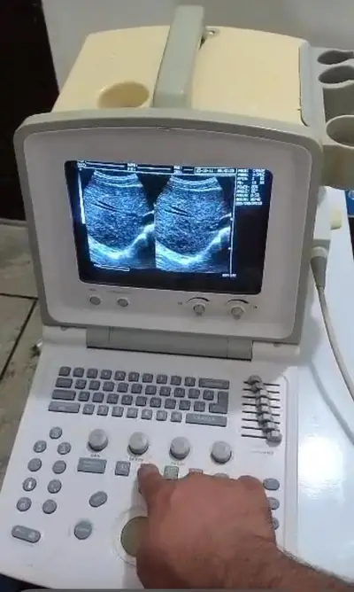 Ultrasound machine in fresh condition from japan / germany uk america

                                                            alt=