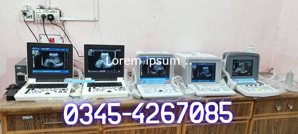 NEW / USED DIFFERENT COLOR DOPPLER JAPANESE / CHINESE ULTRASOUND

                                                            alt=