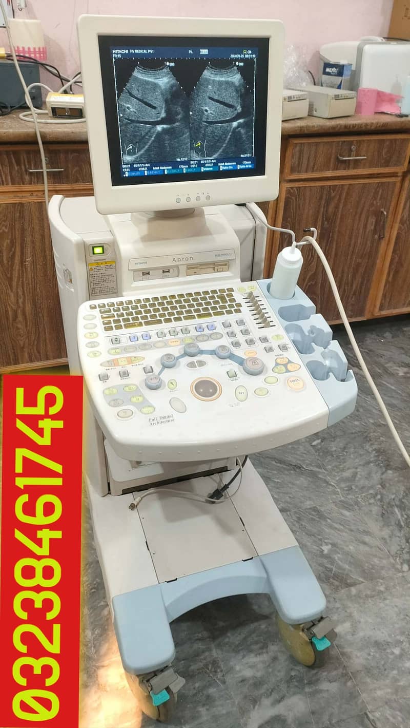 used Hitachi eub-7000 (LCD) japanese colour Doppler ultrasound machine

                                                            alt=