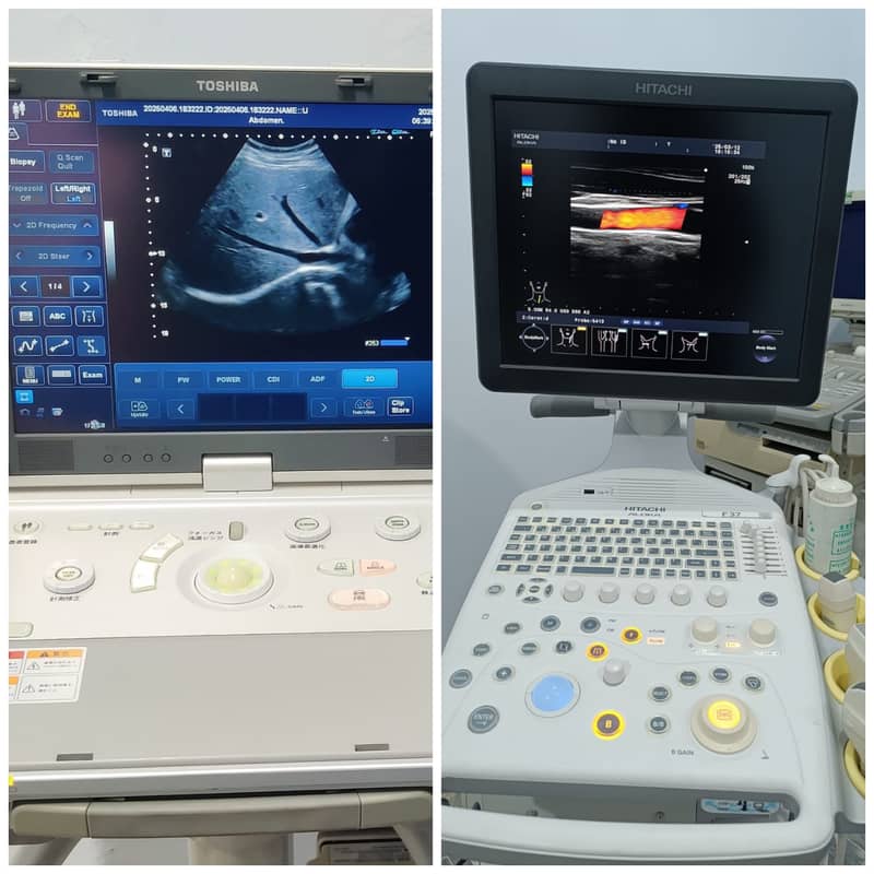 Ultrasound machine Toshiba,Siemens Sonovist Refurbished, Color Doppler

                                                            alt=
