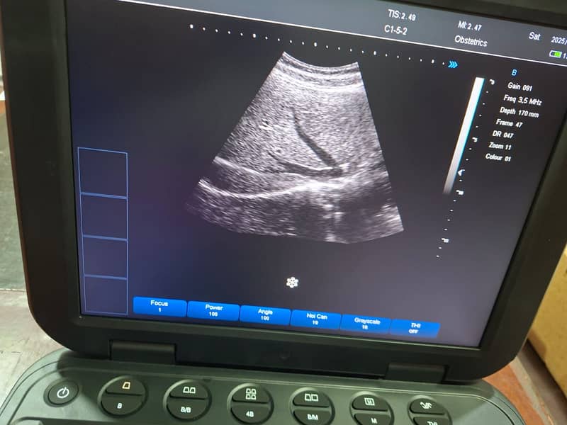 I-15 Ultrasound Machine/Ultrasound Machine/

                                                            alt=