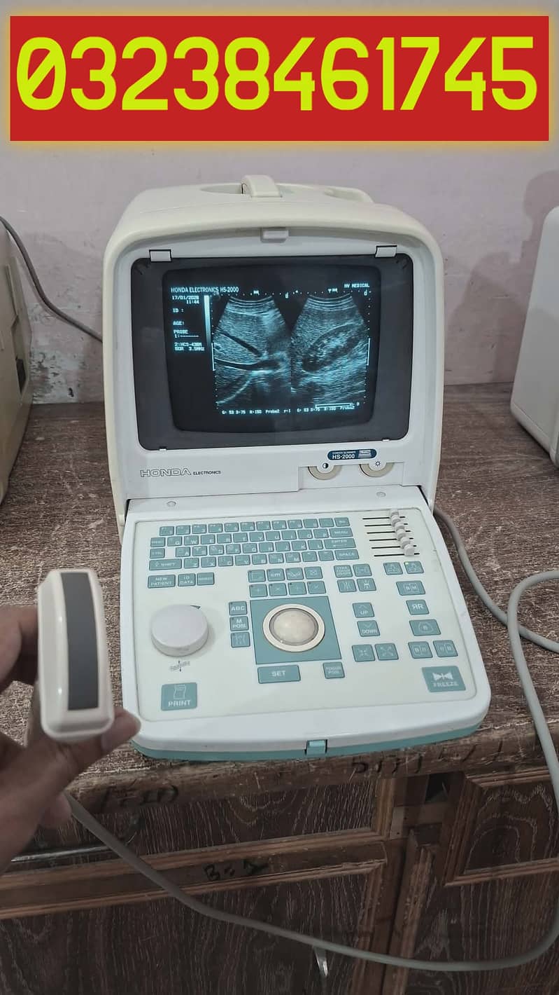 used Honda hs 2000 ultrasound machine

                                                            alt=