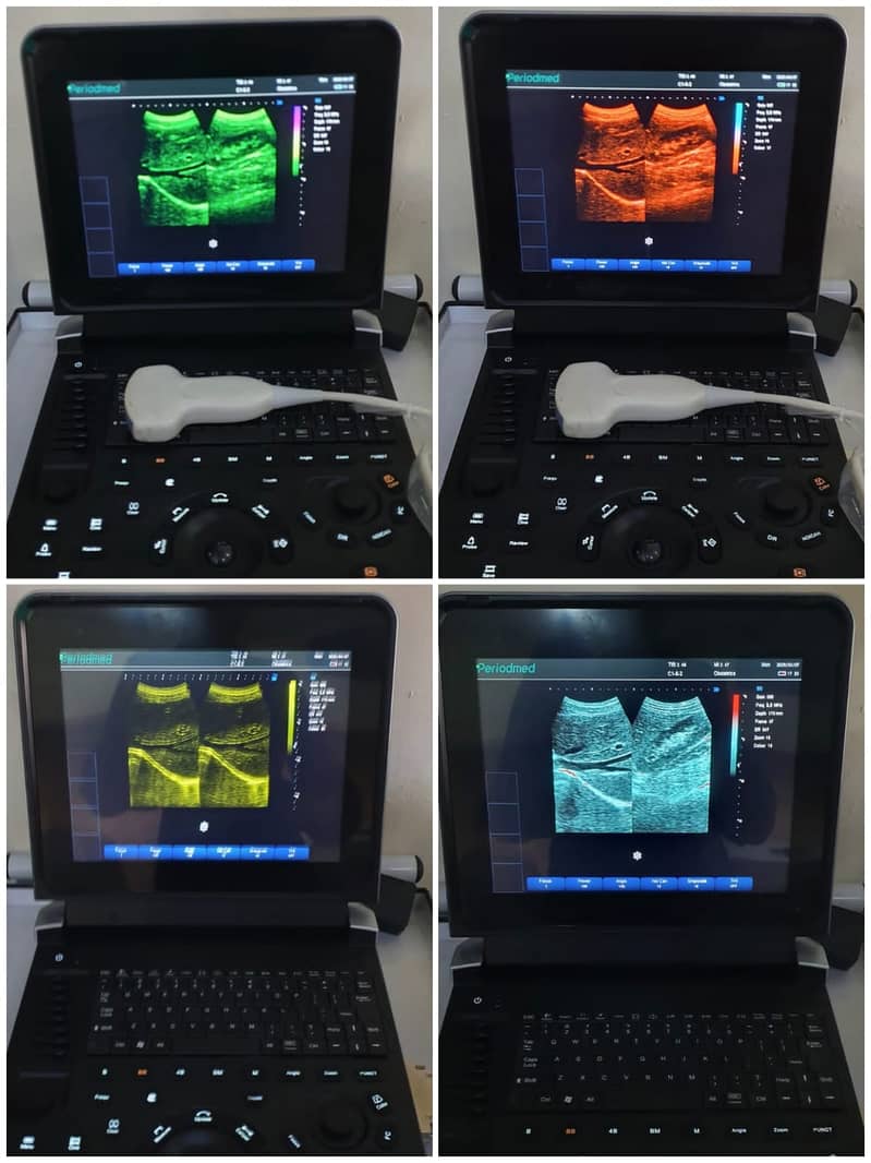 New ultrasound Machines Portable ,notebook /Grey scale ultrasound

                                                            alt=