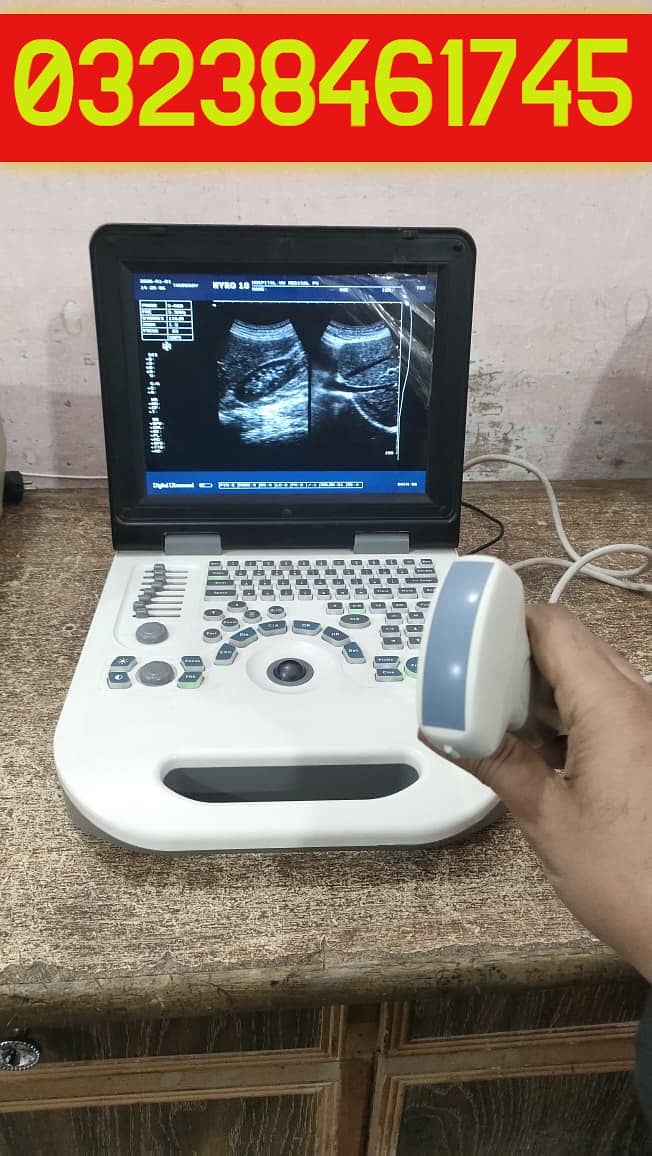 used china nyro 10 portable ultrasound machine with battery backup

                                                            alt=