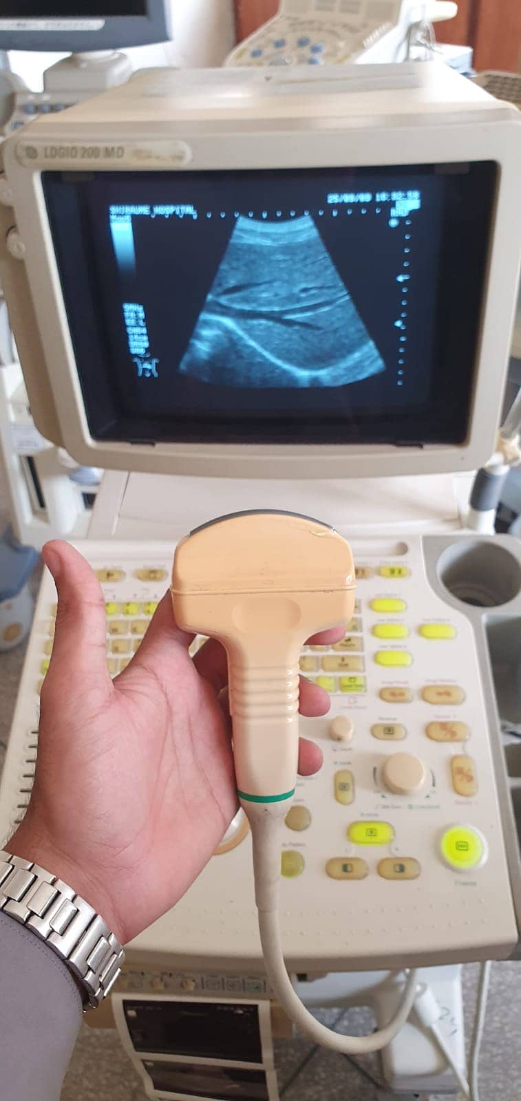 Toshiba,Siemens Sonovist Refurbished, Color Doppler & New Ultrasound

                                                            alt=