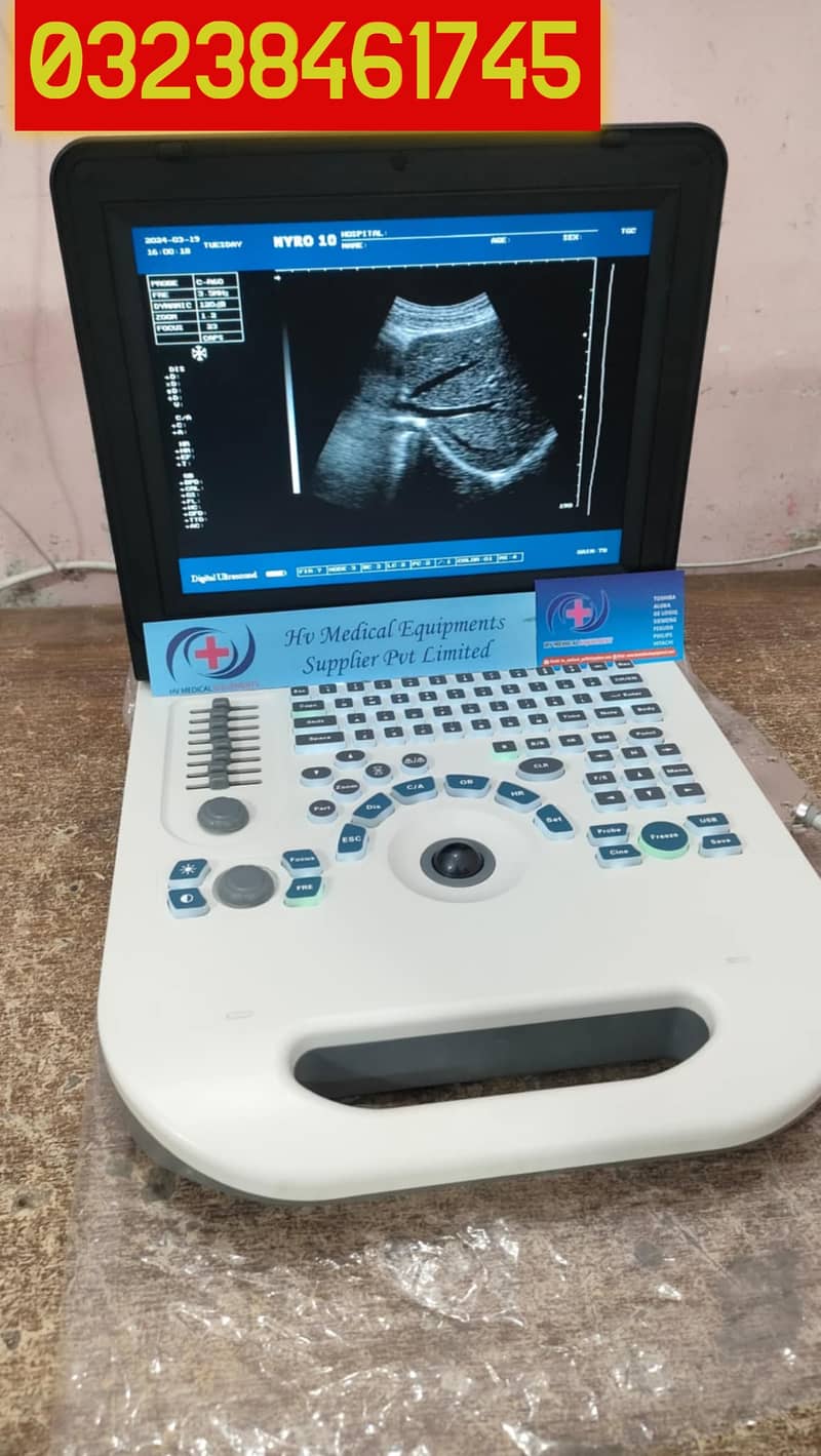 new china nyro 10 portable ultrasound machine with battery backup

                                                            alt=