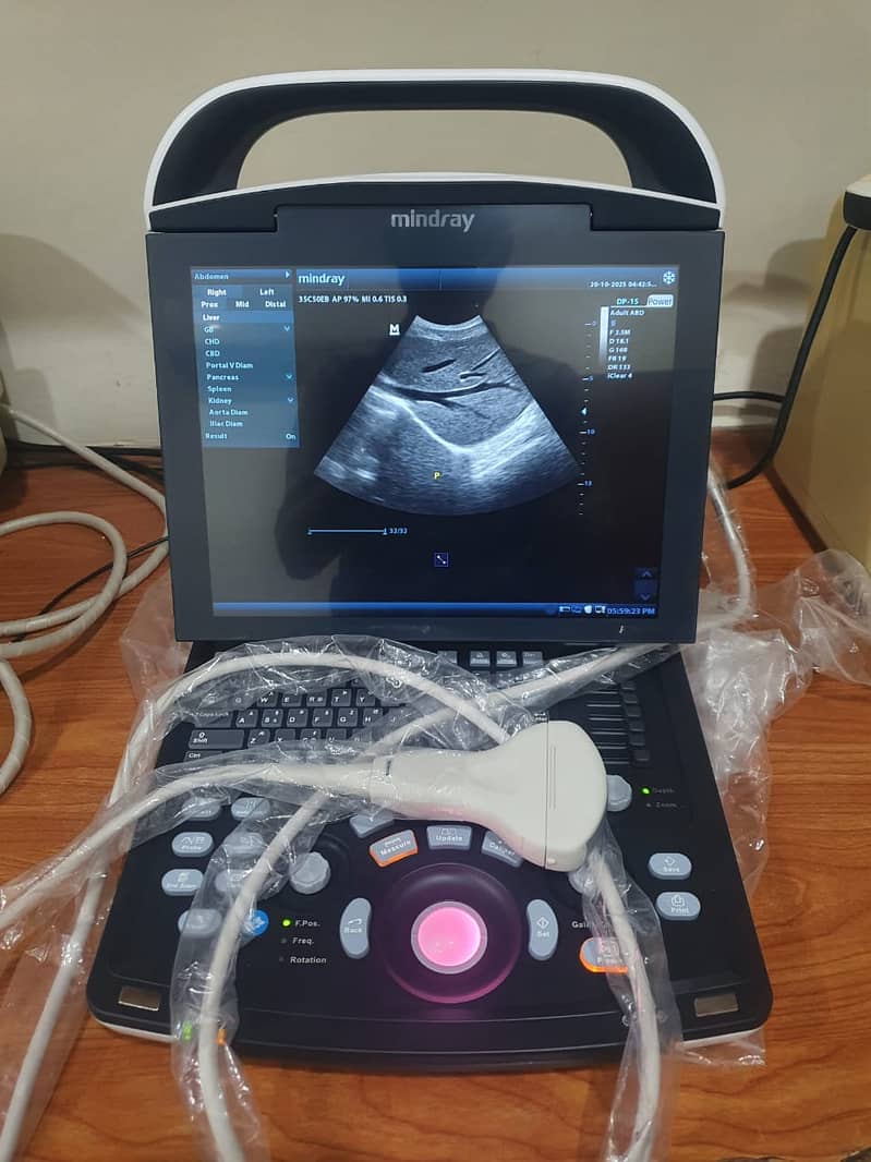 New ultrasound machine,Mindray DP 15 Brand| PW Doppler, Battery Backup

                                                            alt=