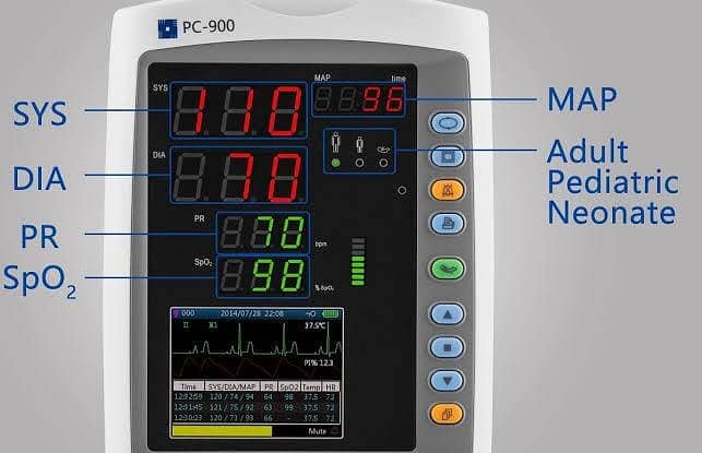 Patient monitor/ ICU monitor/ Cardiac monitor /Hospital monitor

                                                            alt=