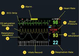 patient cardiac monitor | patient vitals| "NIBP" and "SpO2" bed tables

                                                            alt=